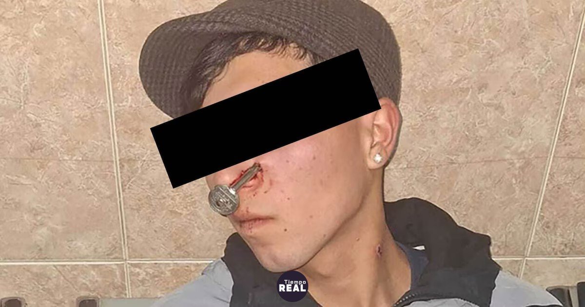 Joven de 17 años recibe una llave clavada en la cara en Laferrere